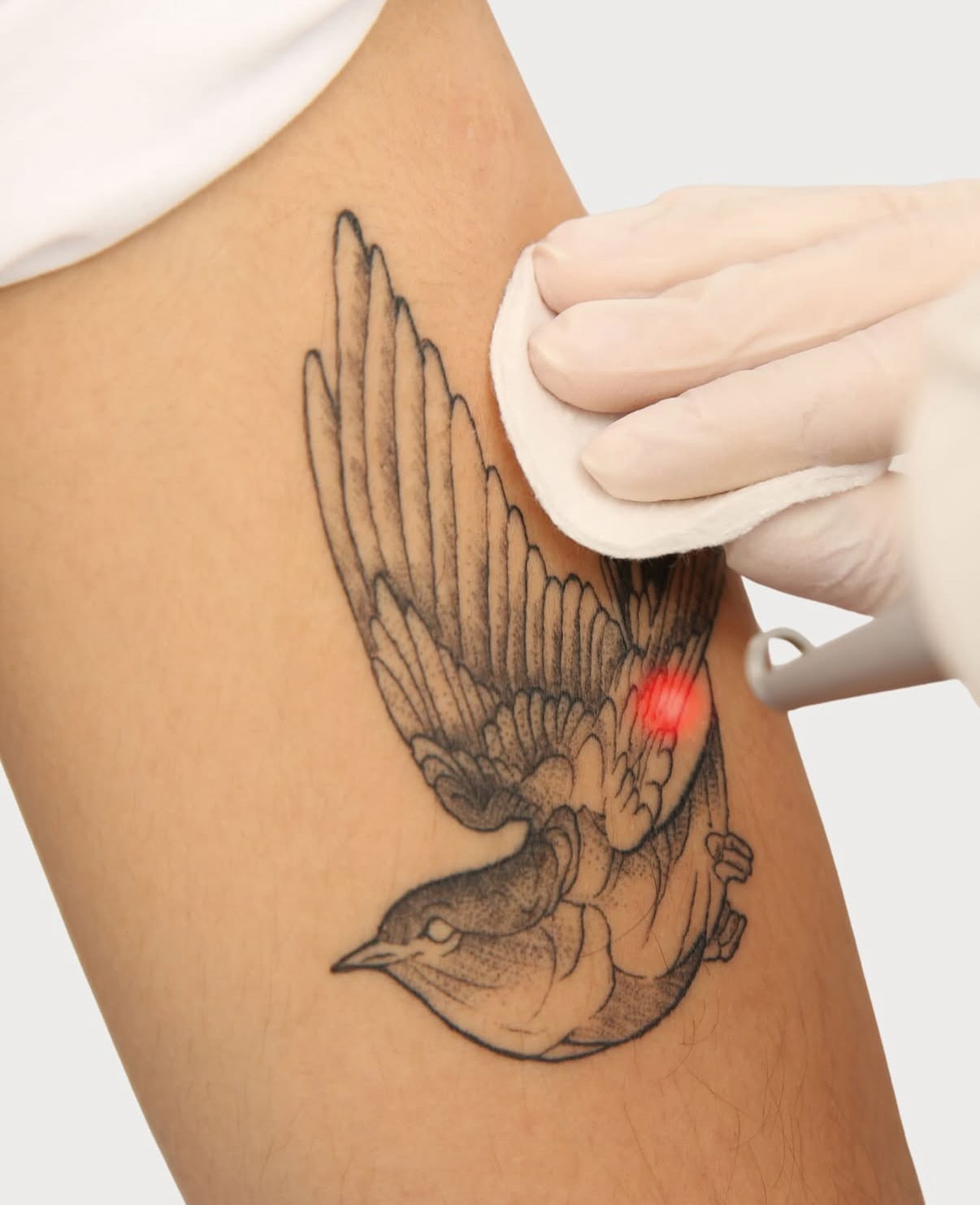 Usuwanie Punktów Rubinowych